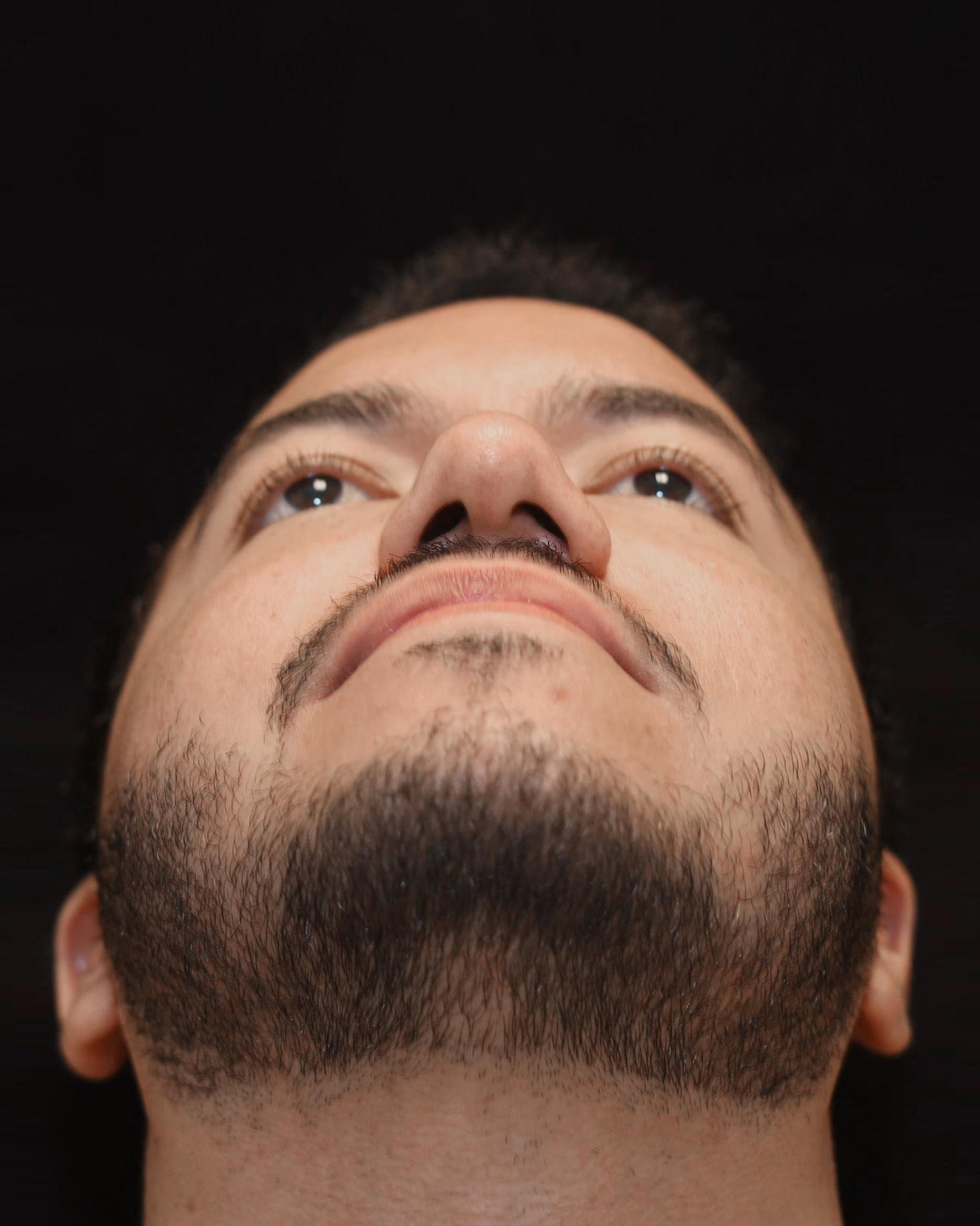 Foto de pré-operatório de rinoplastia masculina